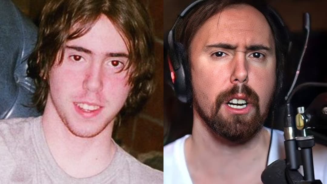 Asmongold Ungkap Rahasia Wajah 'Tikus'nya! 1 Asmongold Ungkap Rahasia Wajah 'Tikus'nya!